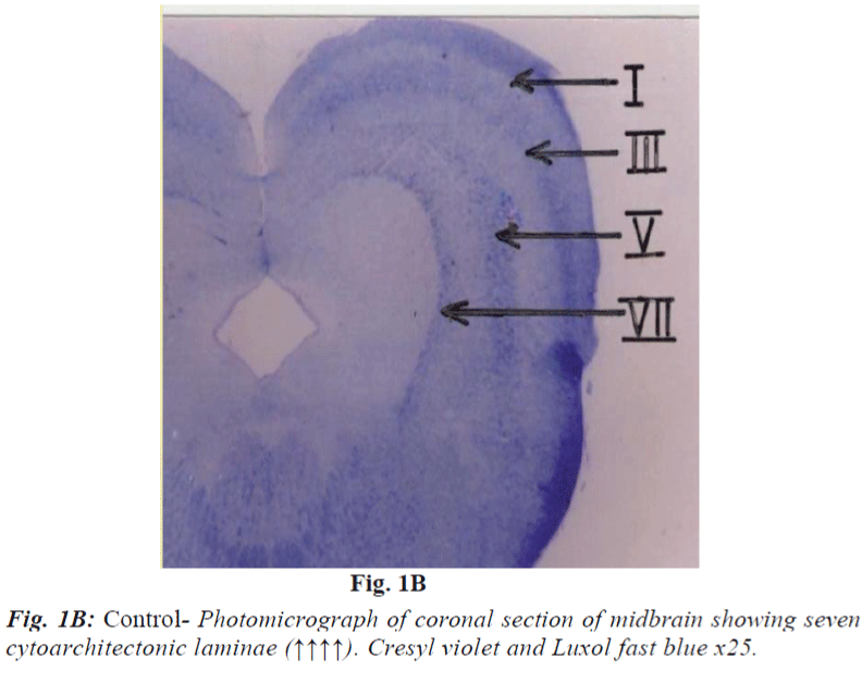 biomedres-Control-Photomicrograph-coronal