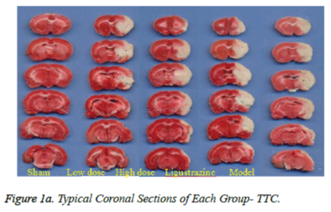 biomedres-Coronal-Sections