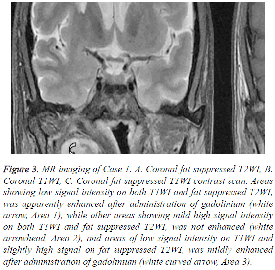 biomedres-Coronal-fat-suppressed