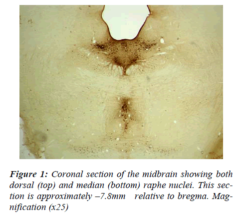 biomedres-Coronal-midbrain-dorsal