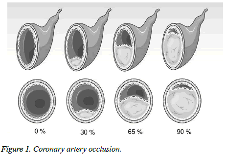 biomedres-Coronary-artery