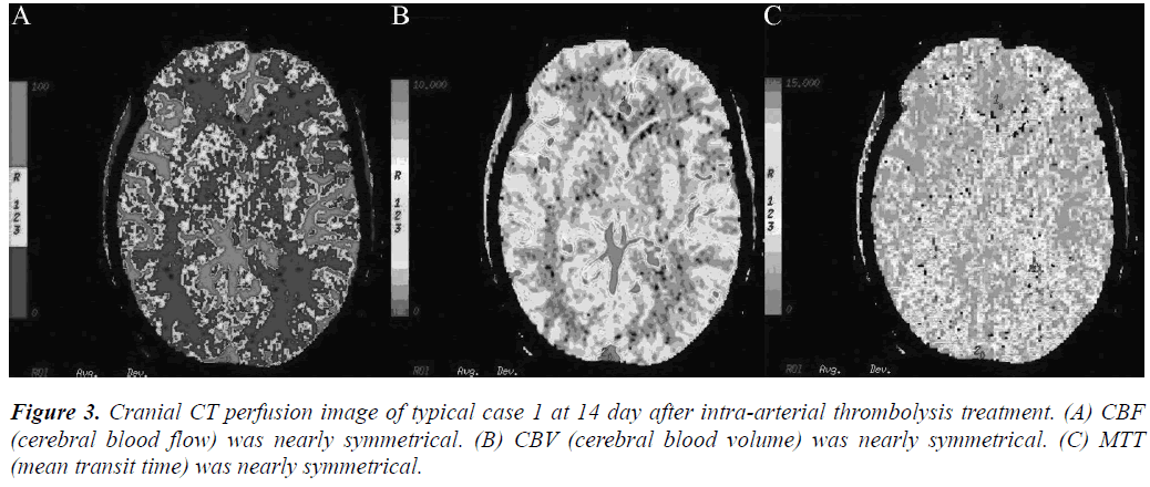 biomedres-Cranial-CT-perfusion