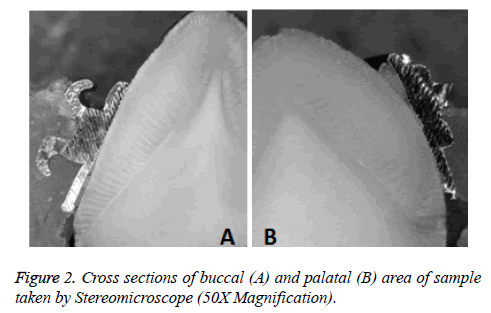 biomedres-Cross-sections-buccal