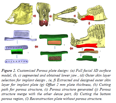 biomedres-Customized-Porous