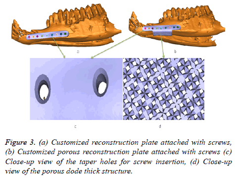 biomedres-Customized-reconstruction