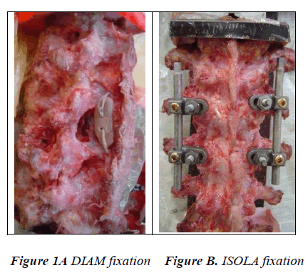 biomedres-DIAM-fixation