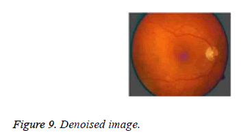 biomedres-Denoised-image