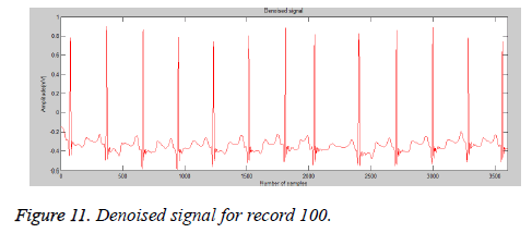 biomedres-Denoised-signal