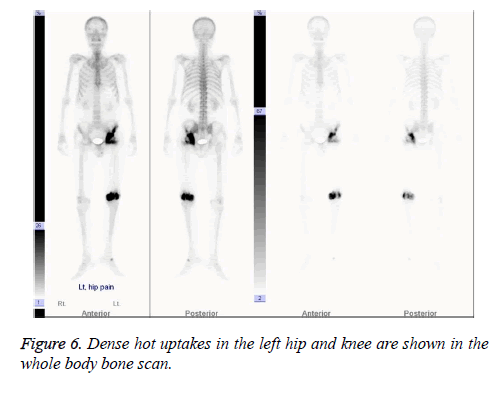 biomedres-Dense-hot