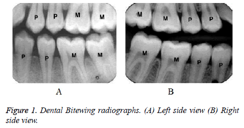 biomedres-Dental-radiographs