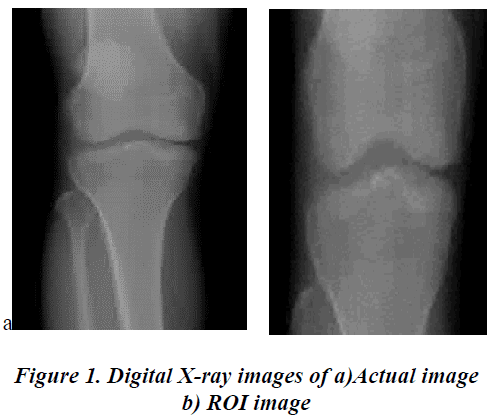 biomedres-Digital-X-ray