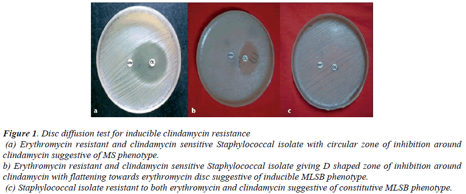 biomedres-Disc-diffusion-test