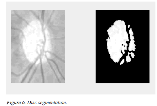 biomedres-Disc-segmentation