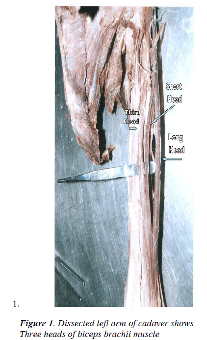 biomedres-Dissected-left-arm-cadaver