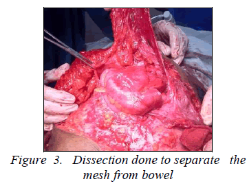 biomedres-Dissection-done