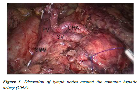 biomedres-Dissection-lymph-nodes