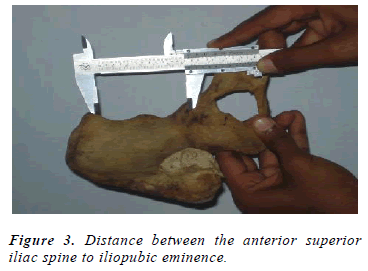 biomedres-Distance-iliopubic-eminence