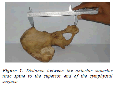 biomedres-Distance-symphysial-surface