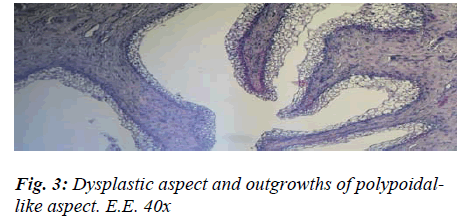 biomedres-Dysplastic-aspect