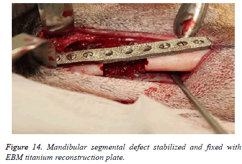 biomedres-EBM-titanium