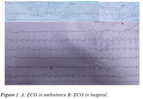 biomedres-ECG-hospital