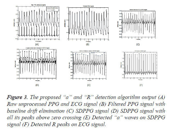 biomedres-ECG-signal