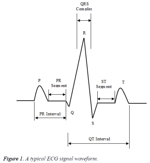 biomedres-ECG-signal-waveform