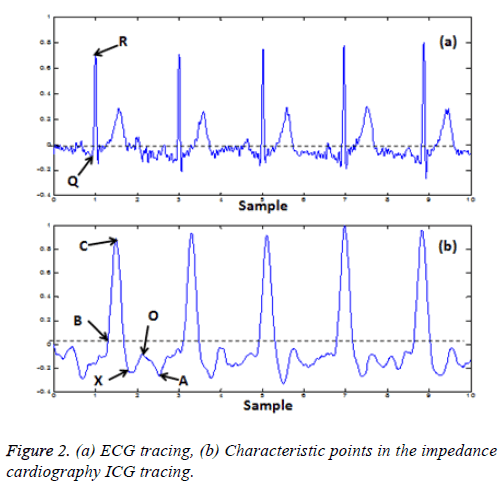 biomedres-ECG-tracing