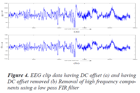 biomedres-EEG-clip-data