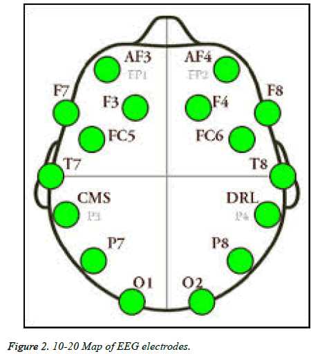 biomedres-EEG-electrodes