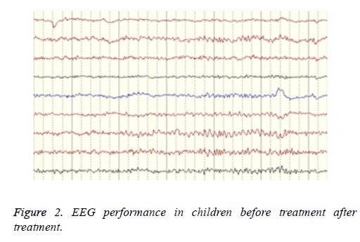 biomedres-EEG-performance