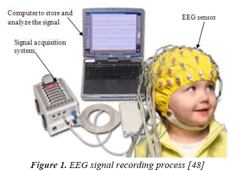 biomedres-EEG-signal-recording