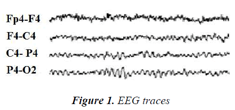 biomedres-EEG-traces