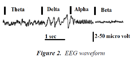 biomedres-EEG-waveform