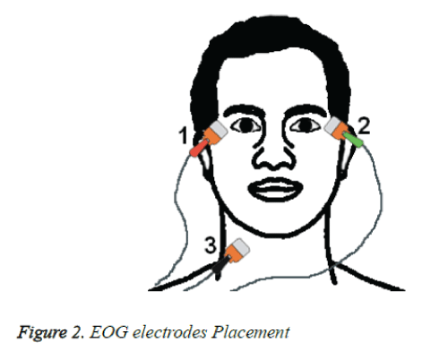 biomedres-EOG-electrodes