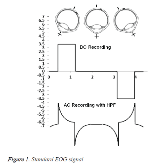 biomedres-EOG-signal