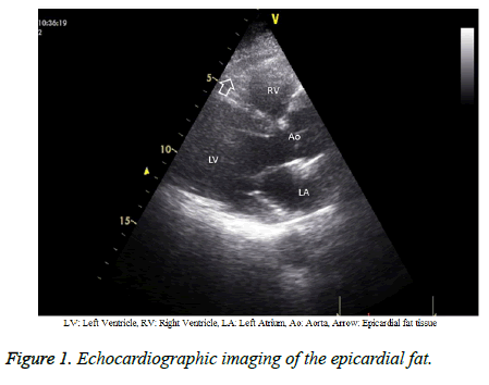 biomedres-Echocardiographic