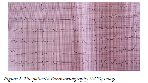 biomedres-Echocardiography