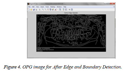 biomedres-Edge-Boundary-Detection