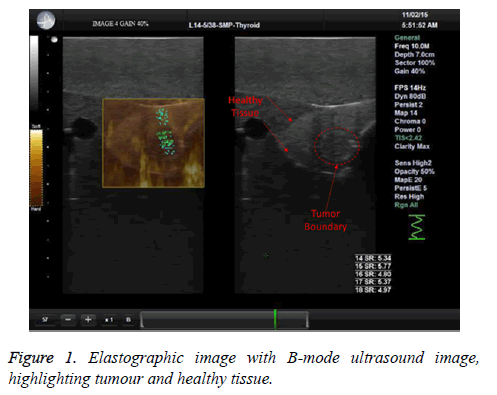 biomedres-Elastographic-image