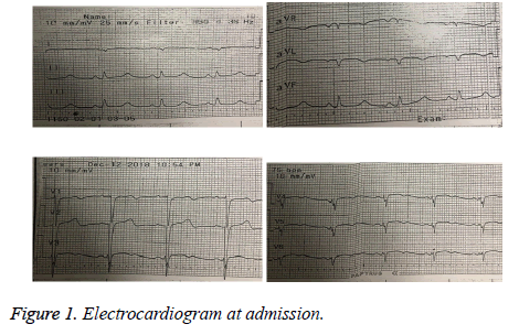 biomedres-Electrocardiogram