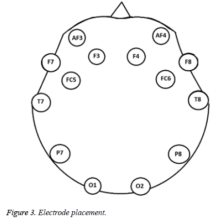 biomedres-Electrode-placement