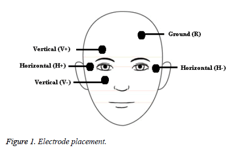 biomedres-Electrode-placement