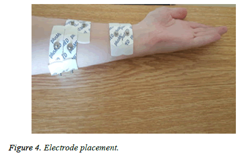 biomedres-Electrode-placement