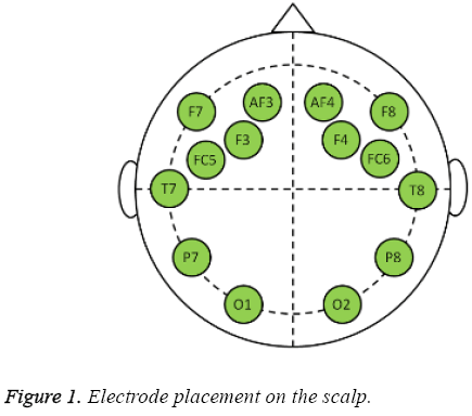 biomedres-Electrode-placement-scalp