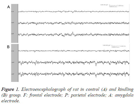 biomedres-Electroencephalograph-rat