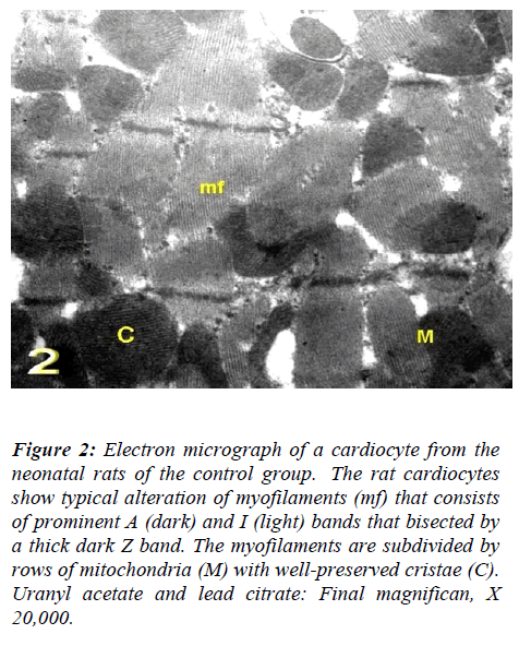 biomedres-Electron-micrograph-Uranyl