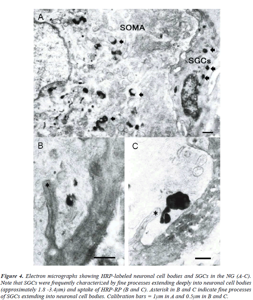 biomedres-Electron-micrographs-showing-HRP-labeled