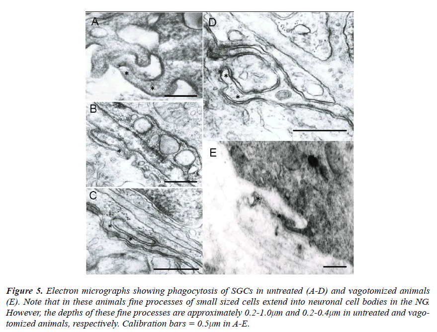 biomedres-Electron-micrographs-showing-phagocytosis