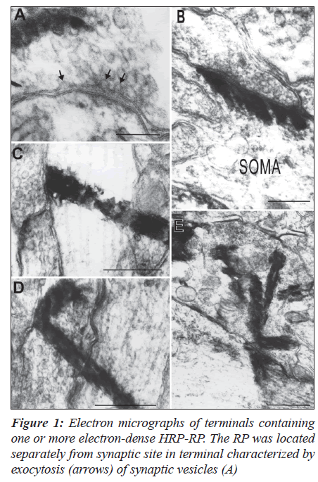 biomedres-Electron-micrographs-terminals